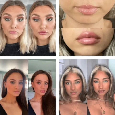 VOLUMINIZADOR DE LABIOS