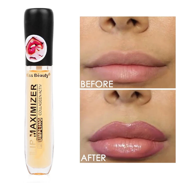 VOLUMINIZADOR DE LABIOS